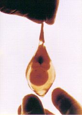 aborted feotus